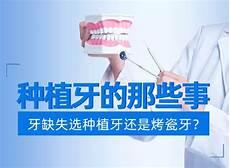 种植牙好用吗