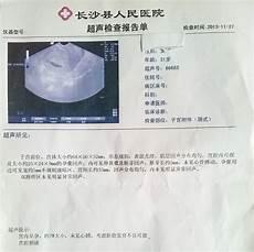 九月十九出生是灵胎吗