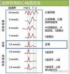人体最高血压