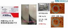 打针去皱